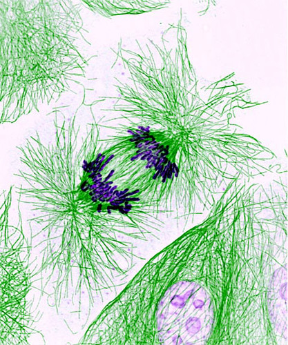 Dividing cells showing chromosomes (purple) and cell skeleton (green) — related to genetic testing for heart abnormalities